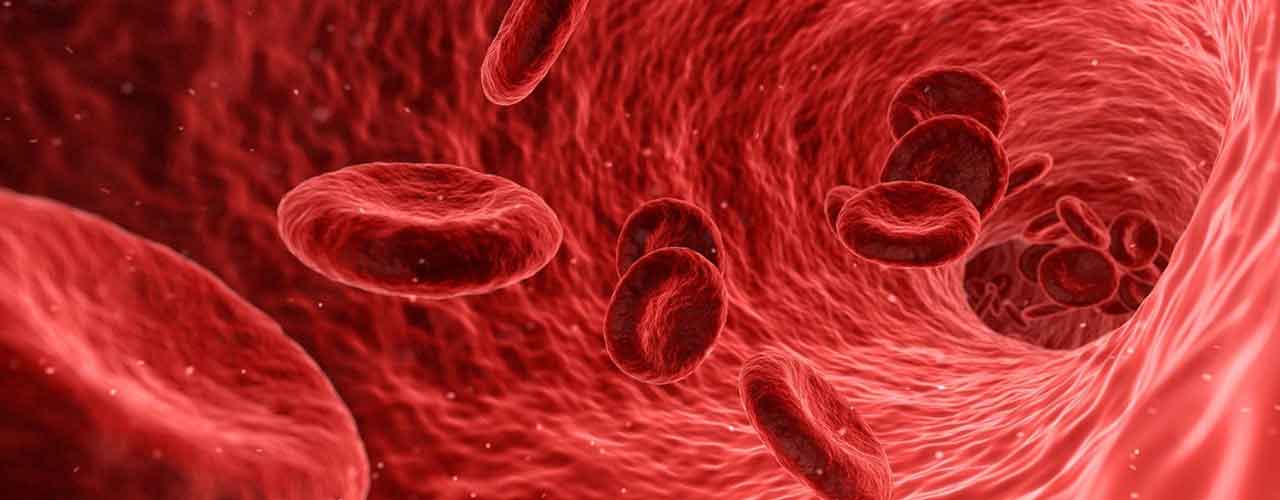 History of hemophilia