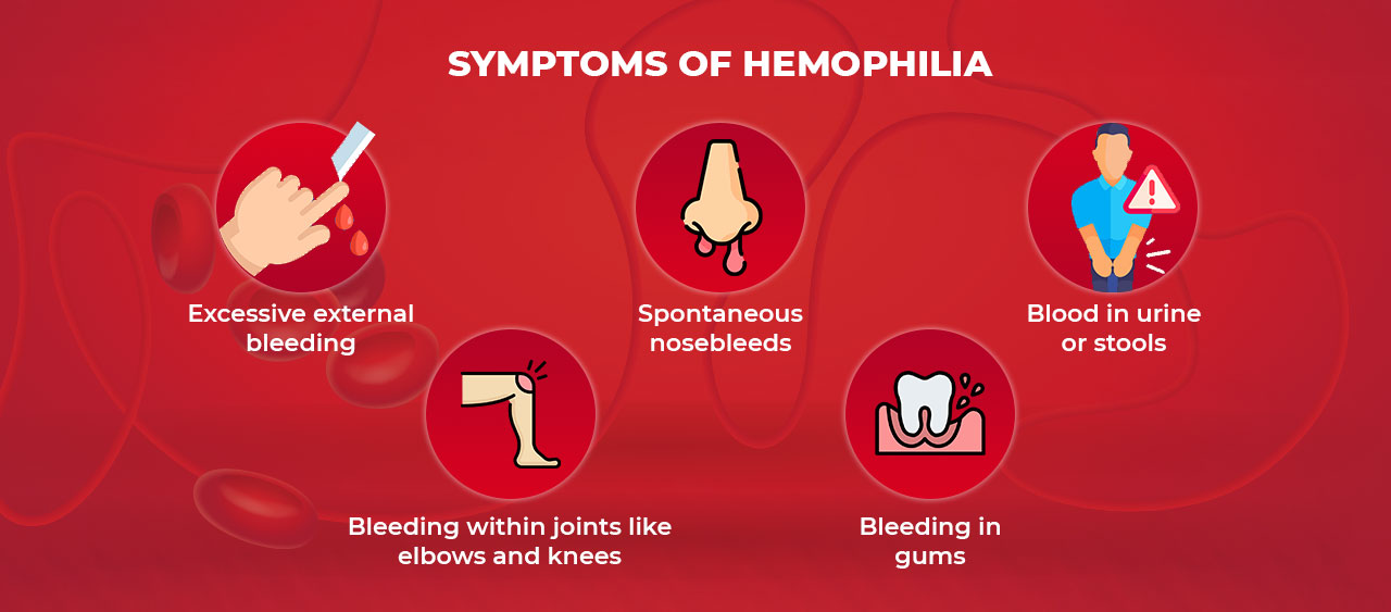 symptoms of hemophilia 2
