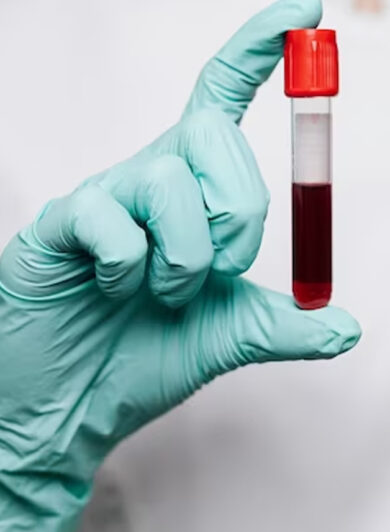 Decoding the Myths: Hemophilia Bleeding Management Made Simple