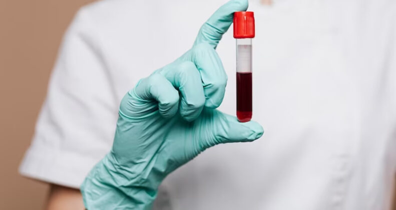 Decoding the Myths: Hemophilia Bleeding Management Made Simple